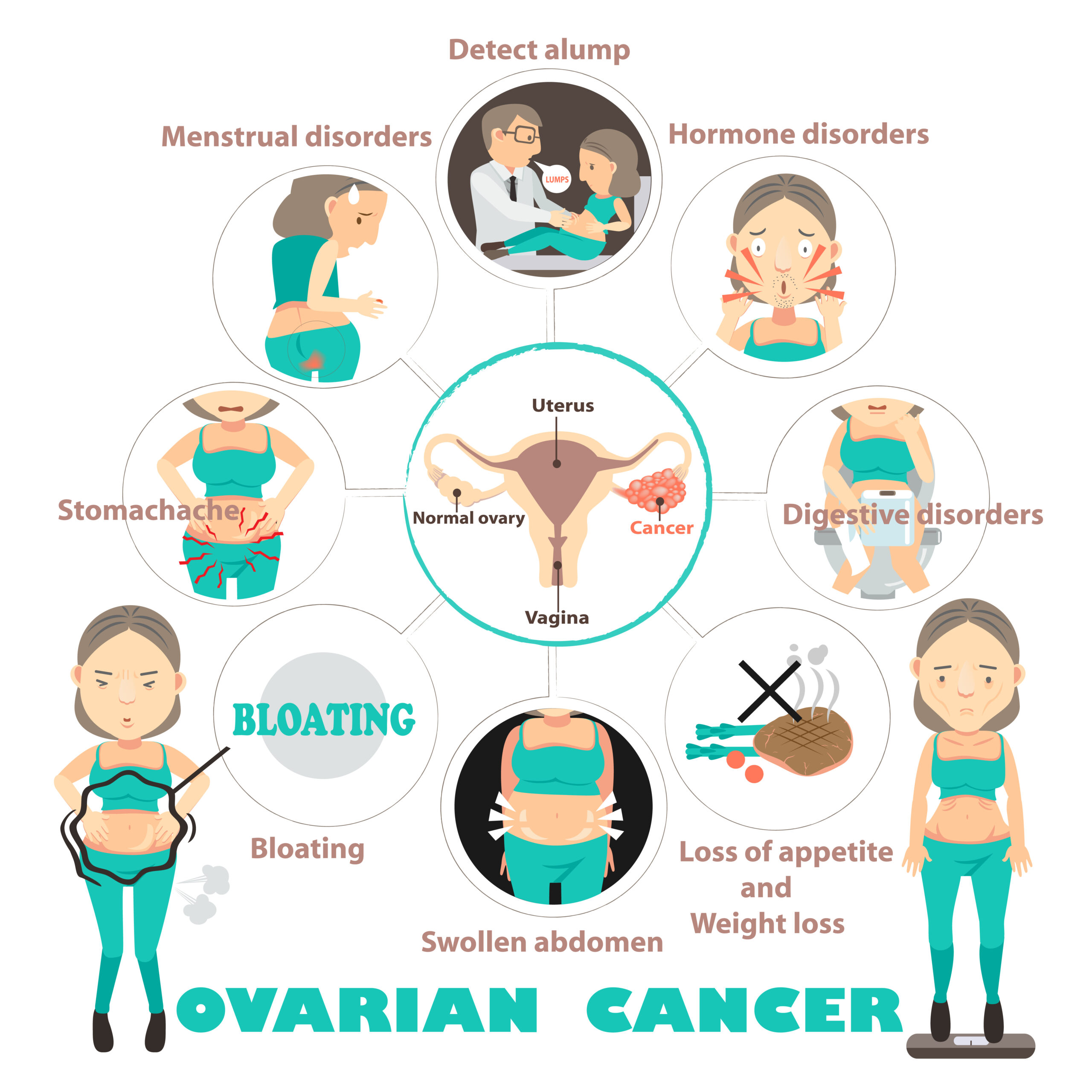 diferentes síntomas del cáncer de ovario