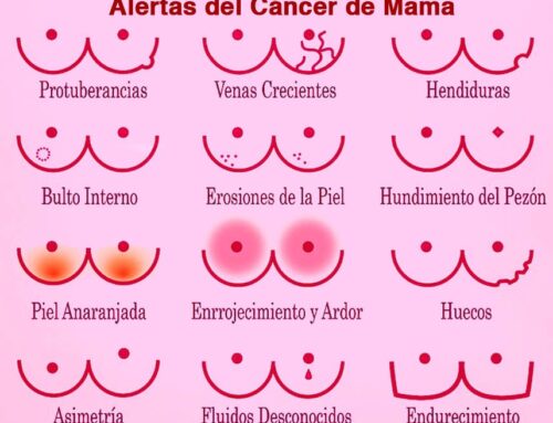 3 datos que debes saber si te diagnostican un cáncer de mama