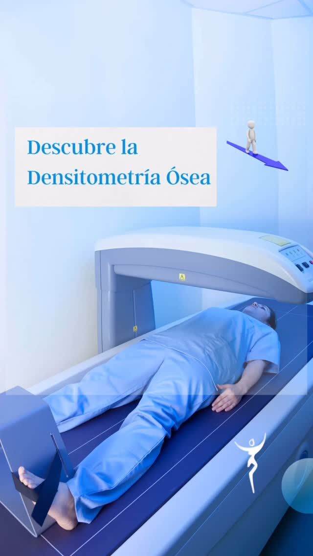 ¿Sabías que la densitometría ósea puede detectar problemas óseos antes de que ocurran fracturas? 🦴✨ En España, más de tres millones de personas padecen osteoporosis, una condición que debilita los huesos y aumenta el riesgo de fracturas en caderas, columna vertebral y muñecas. Con esta prueba, podemos medir la cantidad de calcio y minerales en tus huesos en tan solo 10-30 minutos, utilizando menos radiación que una radiografía normal. ¡No esperes a que sea tarde! Detectar problemas a tiempo te permitirá tomar decisiones adecuadas para tu salud ósea. 💪 Mas info en nuestro blog
#SaludÓsea #PrevenciónOsteoporosis #DensitometríaÓsea #CuidaTusHuesos #ishtarginecología