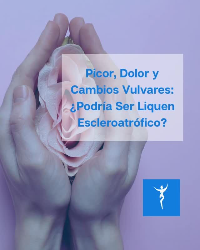 ¿Irritación y cambios en la piel genital? El liquen escleroso podría ser el culpable. 🤔 Consulta con tu ginecólogo para un diagnóstico preciso y mejora tu bienestar íntimo. Descubre más en nuestro blog 👉 www.ishtar.es #SaludÍntima #BienestarFemenino
#LíquenEscleroatrófico#CuidadoDeLaPiel #ishtarginecologia #SaludFemenina #AutoCuidado #ConcienciaDeSalud #CondicionesDeLaPiel #BienestarFemenino #EducaciónEnSalud #ishtarginecología